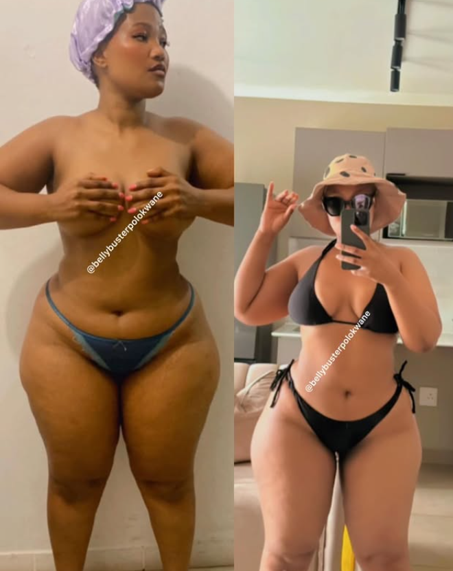 Belly Buster customer before and after transformation
