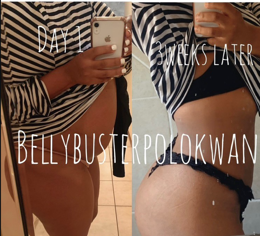 Day 1 vs 3 weeks later